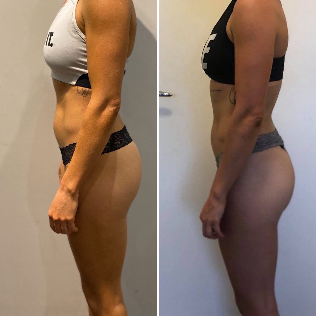 Transformation PT Testimonials | Taking Stock